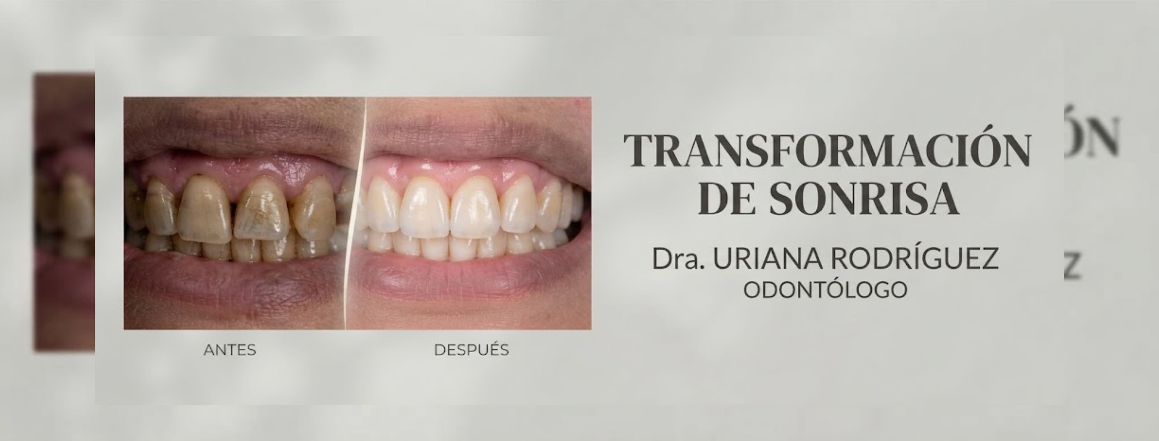 Imagen 2 de Odontólogo Uriana Rodriguez